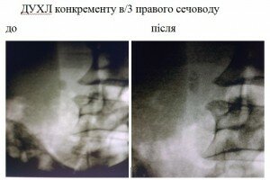ДУХЛ